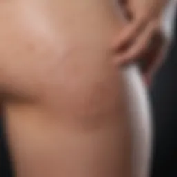 Close-up of a thigh with a rash showing irritated skin