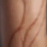 A close-up of scar tissue on skin showing different types.
