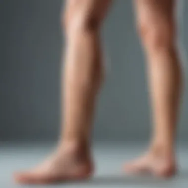 Transformation of Leg Scars with Hydroquinone Leg scars before and after hydroquinone treatment