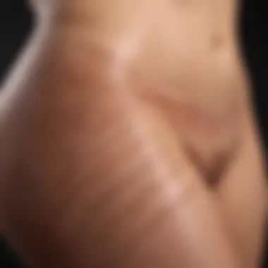 Close-up of skin texture showing stretch marks