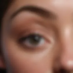 Natural Remedies for Dark Circles