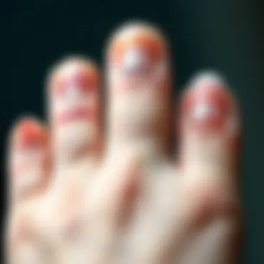 Colored Lines on Nails: Health Insights Diverse colored lines on nails representing various conditions